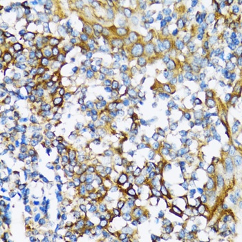 NFKB1 Antibody