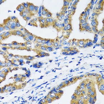 NFKB1 Antibody
