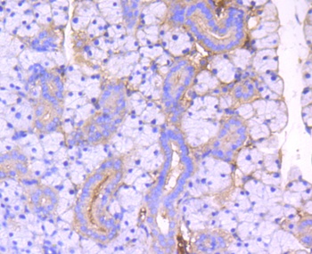 ROCK1 Antibody [H5E4]