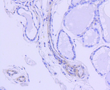 ROCK1 Antibody [H5E4]