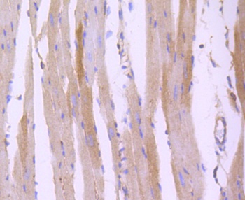 ROCK1 Antibody [H5E4]