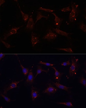 CTGF Antibody