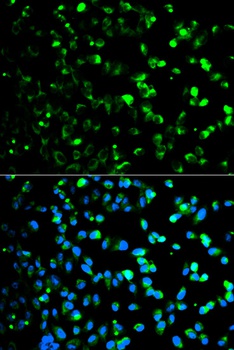 TYMP Antibody