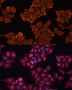 HSD17B1 Antibody