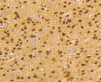 CREB1 Antibody [E0D3]