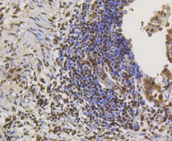 CREB1 Antibody [E0D3]