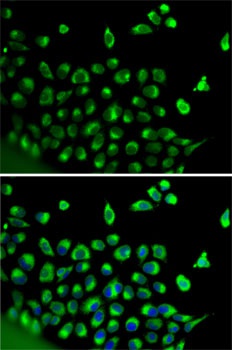 CALR Antibody