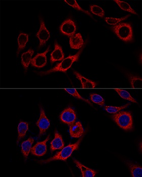 CALR Antibody