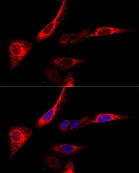 CALR Antibody