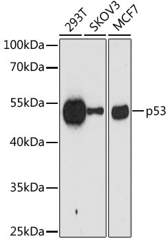 p53 Antibody [8F9G2]