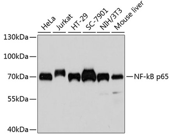 NF-kB p65 Antibody [8F9G2]