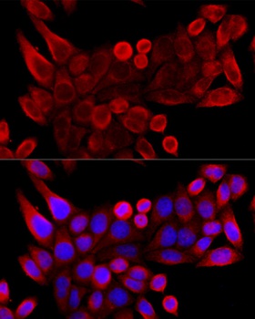 VDAC3 Antibody