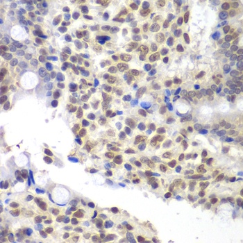 U2AF1 Antibody