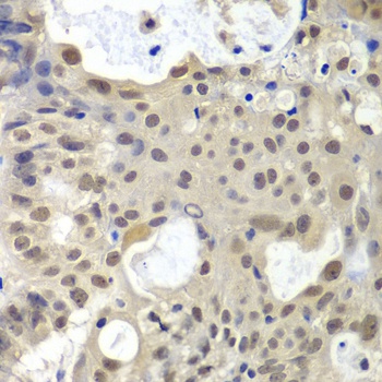 U2AF1 Antibody