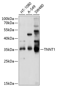 TNNT1 Antibody