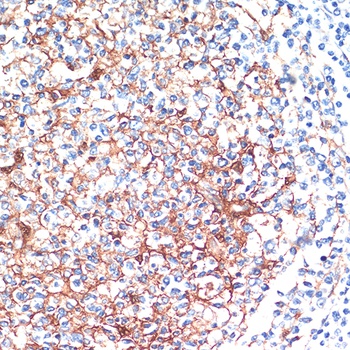 YWHAB Antibody
