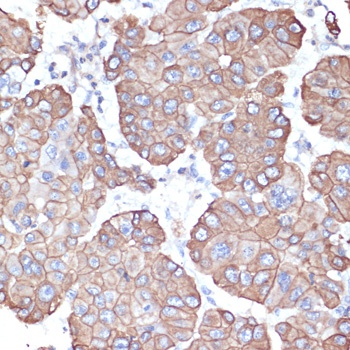 KRT18 Antibody