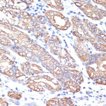 KRT18 Antibody