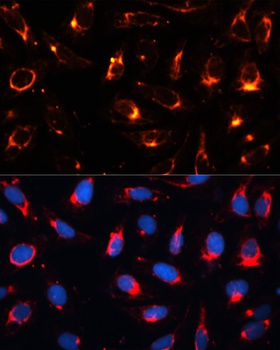 KRT18 Antibody