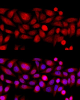 KIF4A Antibody