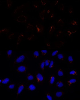 ETHE1 Antibody