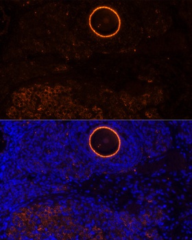 ZP2 Antibody