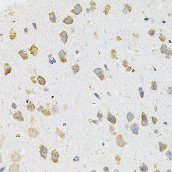 TGM2 Antibody