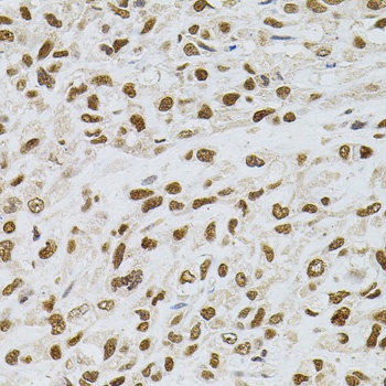 TGM2 Antibody