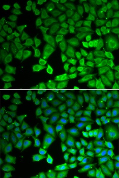 NUR77 Antibody