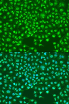 SKP2 Antibody