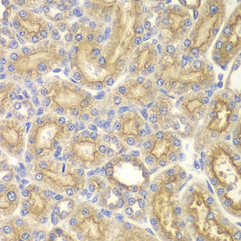 PAK1 Antibody