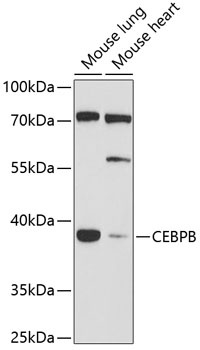 CEBPB Antibody
