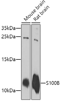 S100B Antibody