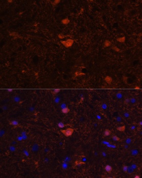 S100B Antibody