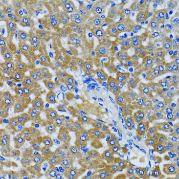 HDAC5 Antibody
