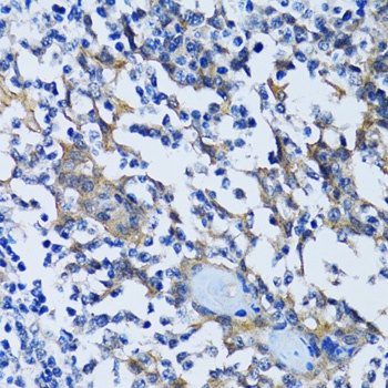 HDAC5 Antibody