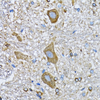 HDAC5 Antibody