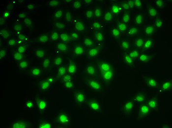 HDAC5 Antibody