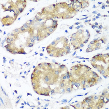 NOTCH2 Antibody