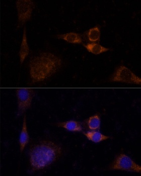 PRKCD Antibody