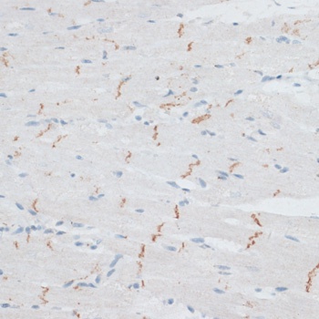 N Cadherin Antibody