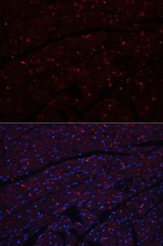 N Cadherin Antibody
