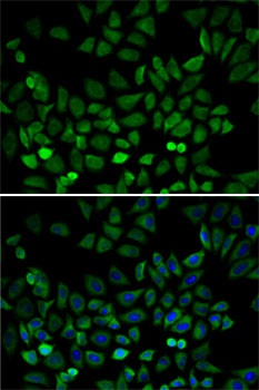 CDK4 Antibody