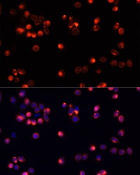 AKT2 Antibody