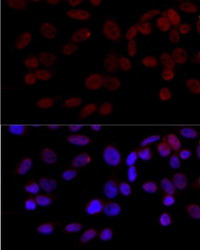 JNK1 Antibody
