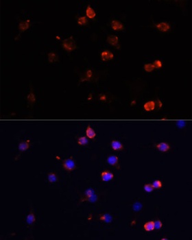 IL6 Antibody