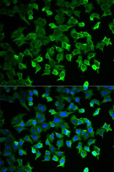 HSP70 Antibody
