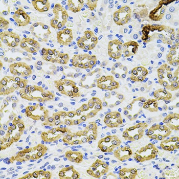 PIK3CA Antibody