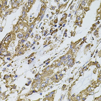 PIK3CA Antibody