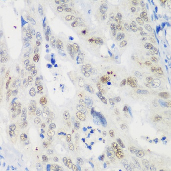 p53 Antibody